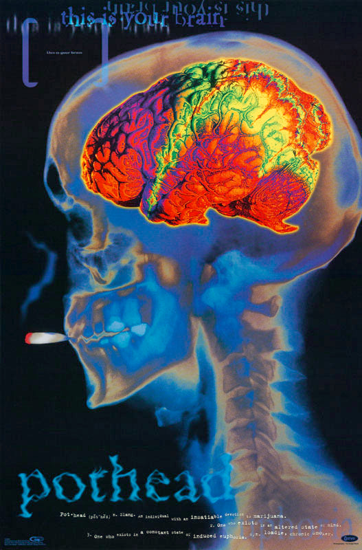 MJ - POTHEAD-THIS IS YOUR BRAIN - POSTER FW1J